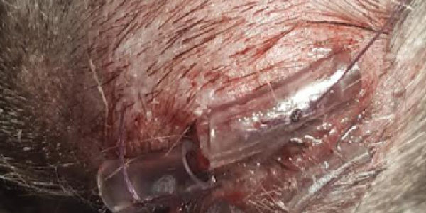 How to Prepare for a Proptosis