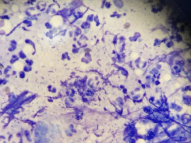 Dermatology Diagnostics