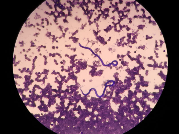 Heartworm: Current Trends and Updates on Diagnosis and Prevention
