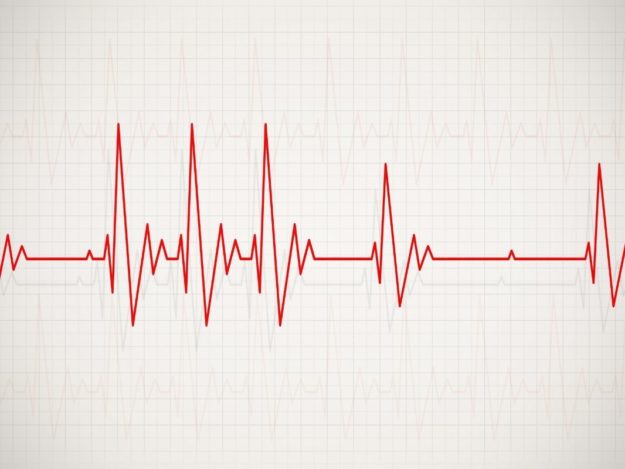 Approach to Emergent Arrhythmias