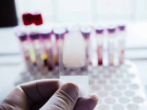 Immune Mediated Thrombocytopenia - What the Deuce?!?