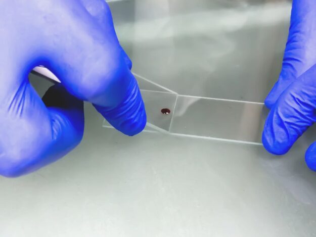 Cytology Part 1: Sample Collection, Processing, and Slide Preparation