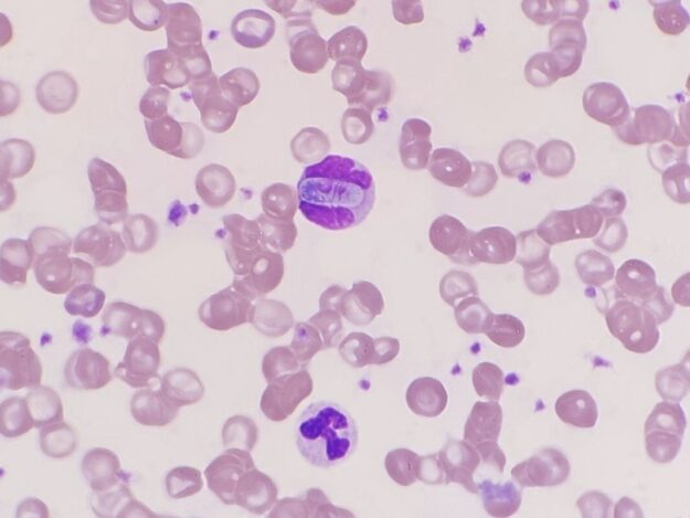 Hematology Part 2: Microscopic blood cell identification