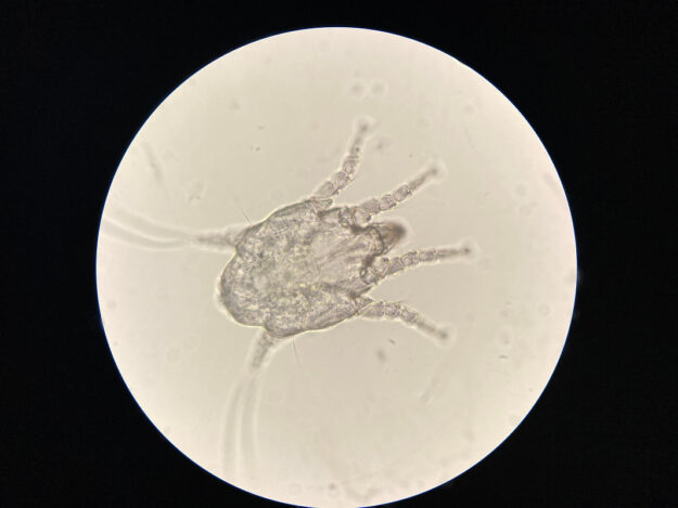 Parasitology Part 2: Microscopic parasite identification