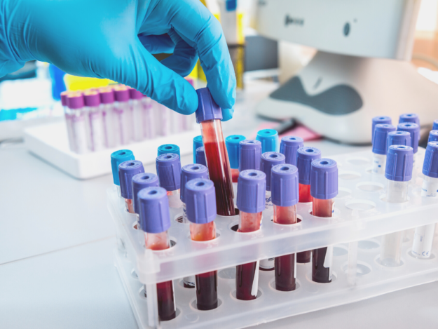 Blood Chemistries: Sample Collection, Handling, and Testing Considerations