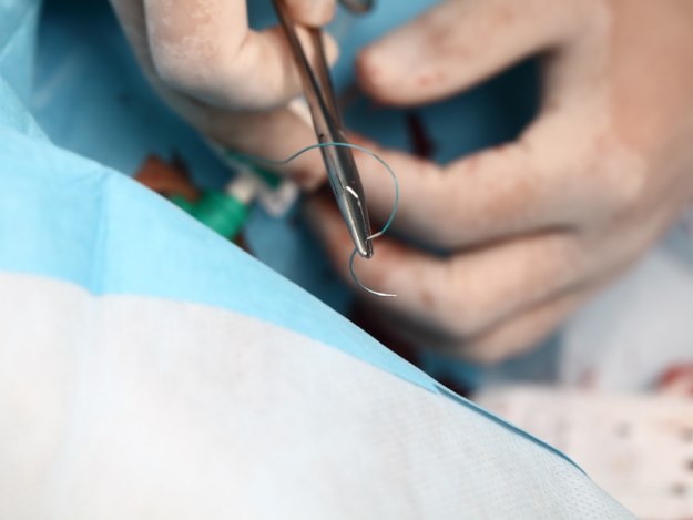 "Oh Sew Easy" - Understanding Suture Materials